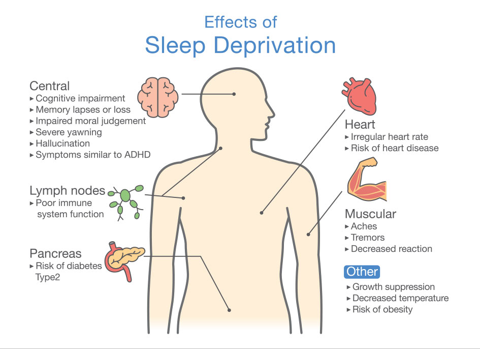 Diagram of Effects of Sleep deprivation. Illustration about disease diagnosis.